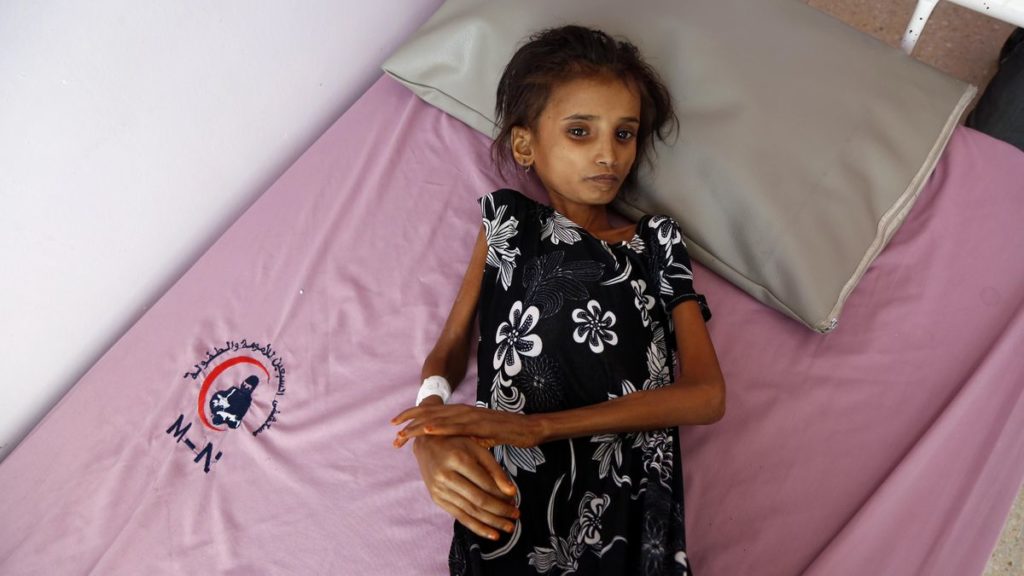 UN Warns 400,000 Yemeni Children May Starve To Death In 2021