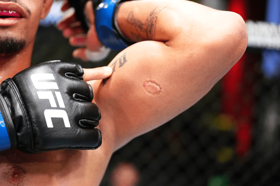 ‘Muzzle him’: Fighters react to UFC on ESPN 53 biting incident